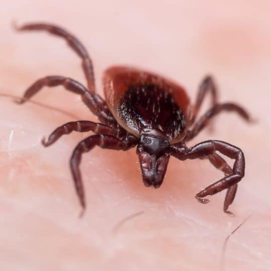 rocky mountain spotted fever